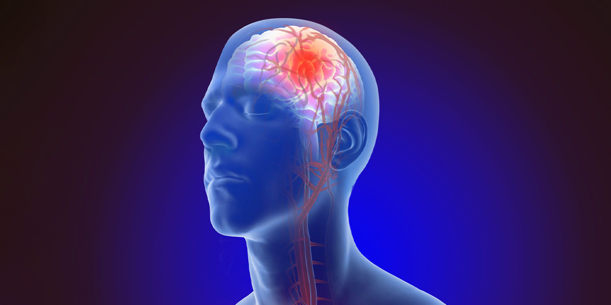 Kavernom ve Kolloid Kist