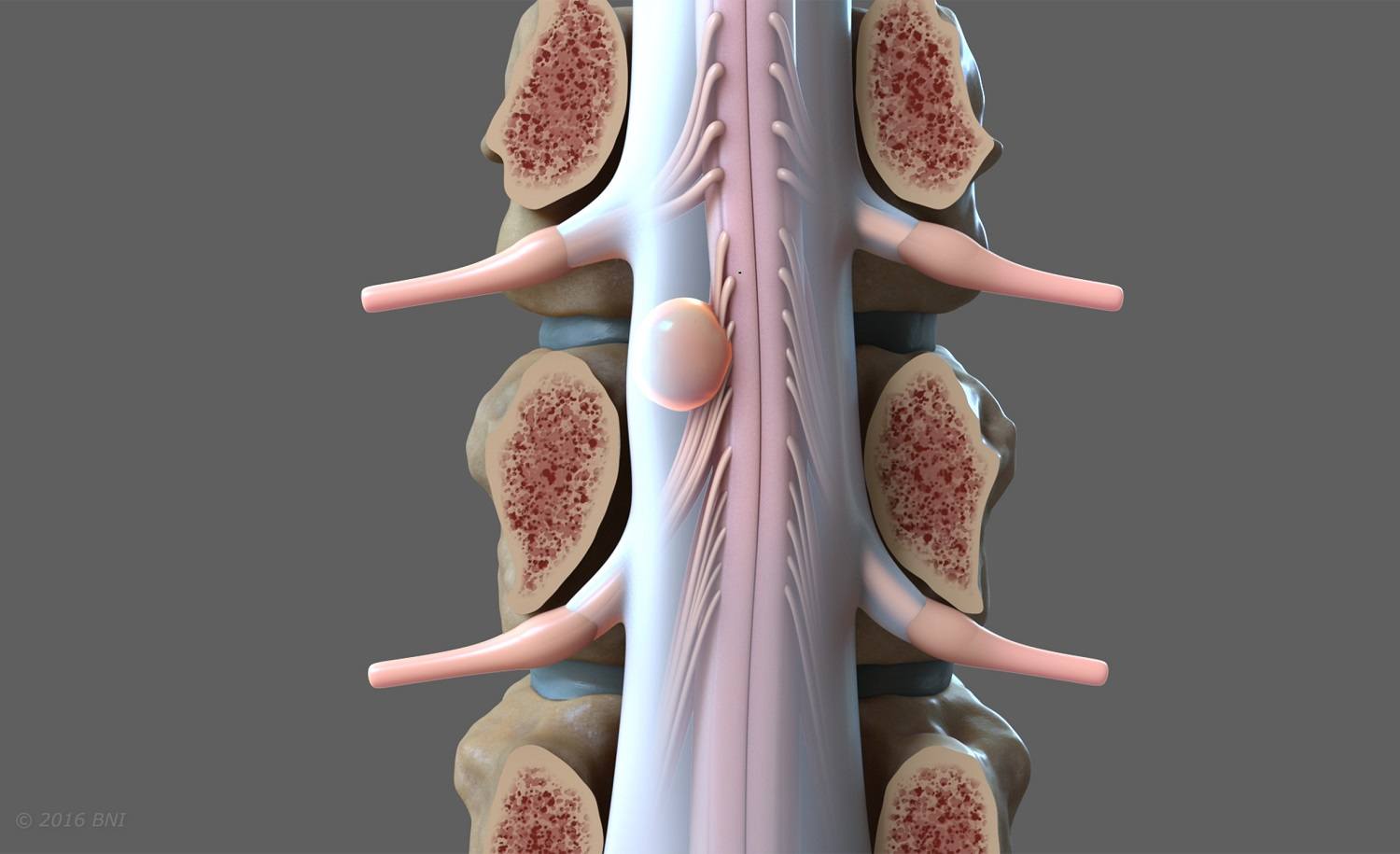 Nöroonkoloji ve Pediatrik Nöroonkoloji